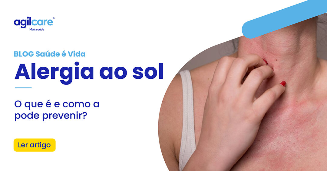 Alergia ao sol: o que é e como a pode prevenir? - Agilcare | Plano de ...