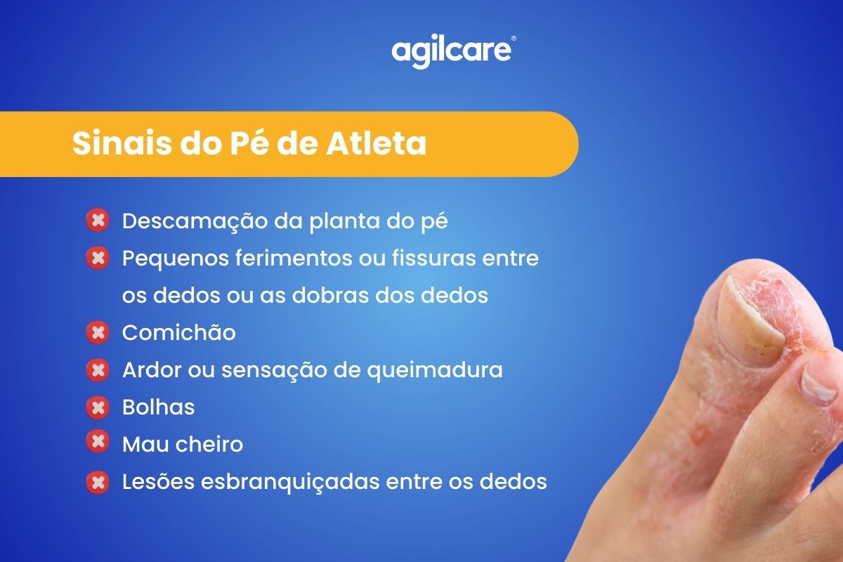 Pé de Atleta: como se trata e previne? - Agilcare | Plano de Saúde ...