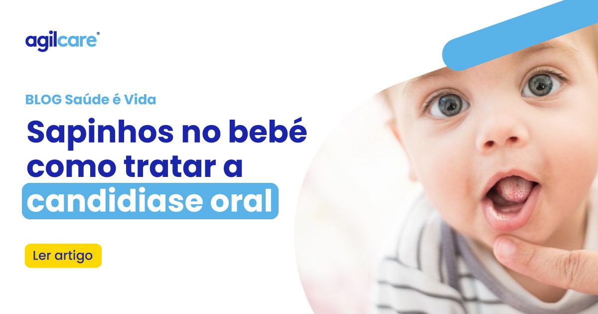 Sapinhos no bebé: como tratar a candidíase oral - Agilcare | Plano de ...